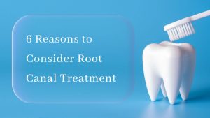 6 Reasons to Consider Root Canal Treatment