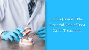 Saving Smiles The Essential Role of Root Canal Treatment in Dental Care