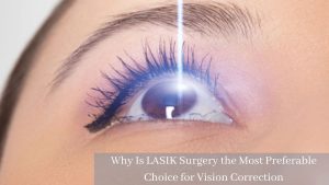 Why Is LASIK Surgery the Most Preferable Choice for Vision Correction