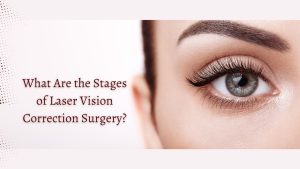 What Are the Stages of Laser Vision Correction Surgery