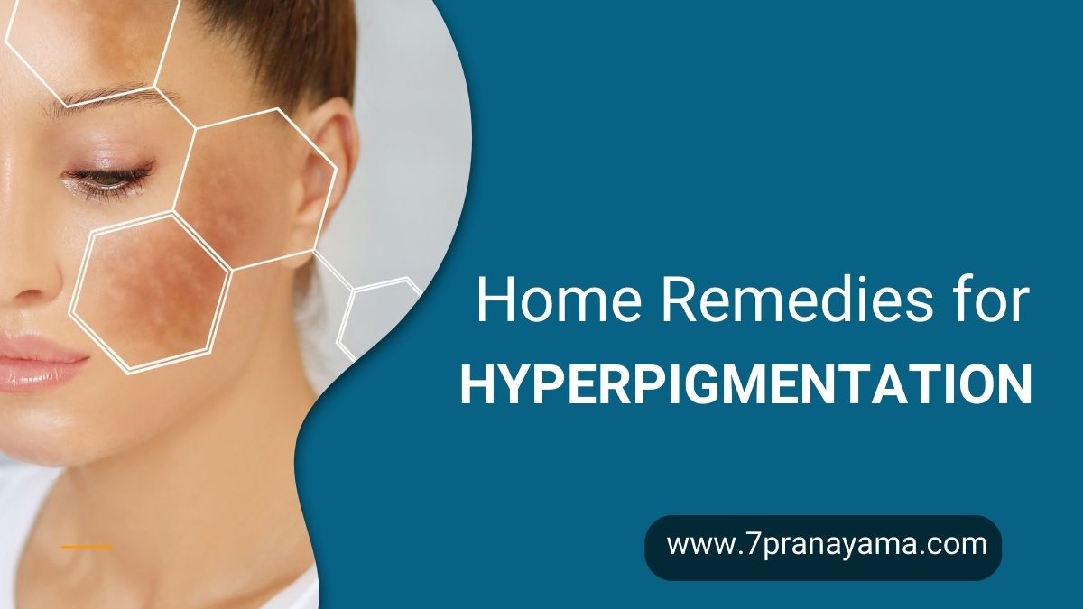 Home Remedies for Hyperpigmentation