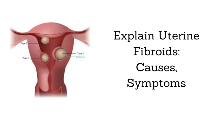 Explain Uterine Fibroids Causes, Symptoms