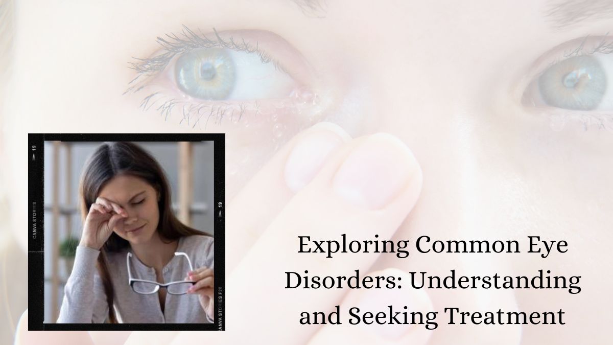 Exploring Common Eye Disorders Understanding and Seeking Treatment