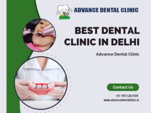 Best Dental Clinic in Delhi