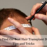 How to Find the Best Hair Transplant Doctor Tips and Tricks