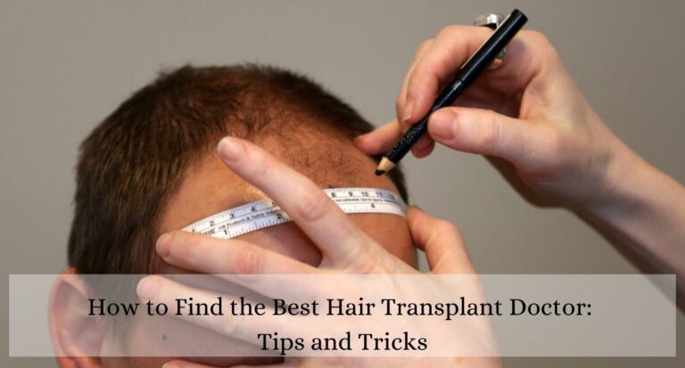 How to Find the Best Hair Transplant Doctor Tips and Tricks